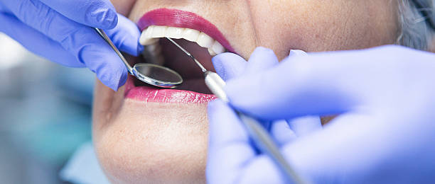 Best Emergency Broken Tooth Repair in Farmington, MS